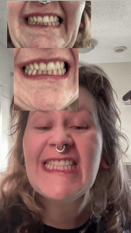 Brush your teeth… and let’s see those results