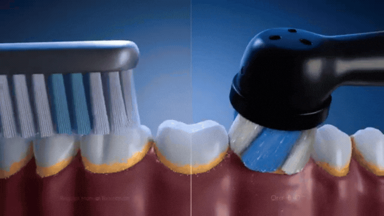 Oral-B iO2: Cleans where manual brusher don't - 100% cleaner teeth vs. a manual tooth brush